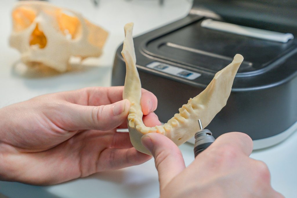 A person holding a fake tooth in front of a machine